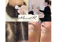 アベニール(AveniR)