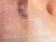 メンズビューティサロン ブレス(bless)