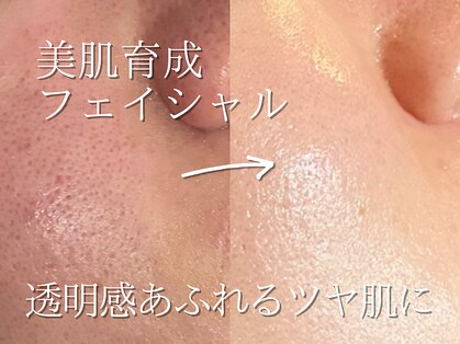 メンズビューティサロン ブレス(bless)の写真