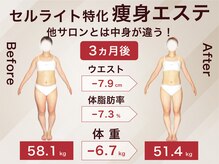 ラ パルレ 新宿新南口店/全身セルライトケア