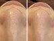 サロンドエルサ(Salon de ELSA)の写真/毛穴の角栓・黒ずみ・開きを解決！粒子の細かい国産ハーブピーリングでつるすべ肌へ◎