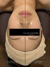 ラヴィエ ベル(La vie est belle)/フェイシャル