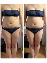 ヨサ パーク コアハート(YOSA PARK CORE HEART)/ウエストライン