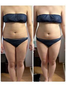 ヨサ パーク コアハート(YOSA PARK CORE HEART)/ウエストライン