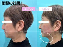 カンナムビューティー 新宿 代々木/オンダリフト/新宿/ララピール