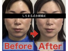 アベックトア(Avectoi)/小顔サロンで今から変われます！