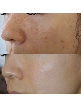 ザ シー タイムレスビューティ(THE SHE)/30代お客様症例写真