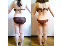 セルビューティー(Cell Beauty)