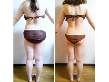 セルビューティー(Cell Beauty)