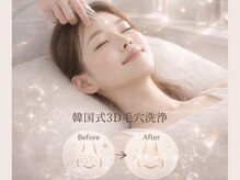 アネラ(ANELA)の雰囲気（SNSで話題の最新技術【韓国式3D毛穴洗浄】山口県で初導入！）