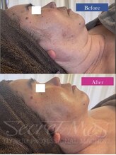 メンズエフディ ファウンデーション(メンズFD)/最強小顔