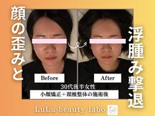 ルルラボ(LuLu beauty labo)/顔の歪みと浮腫みを撃退！