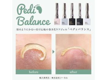 アクシア(Axia)の写真/親指以外も巻き爪ケア対応◎ワンカラーしながら巻き爪ケアで指先を美しく彩る♪