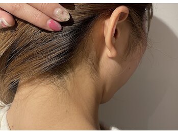 フォクシーワックス 立川店(FOXY WAX)/【ビフォー】うなじ