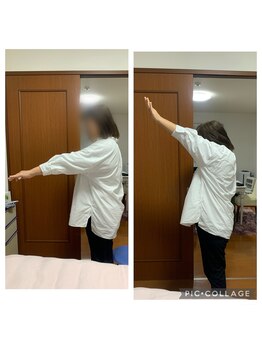 カインド整体院(KiND整体院)/一回の施術でこんな変わりました