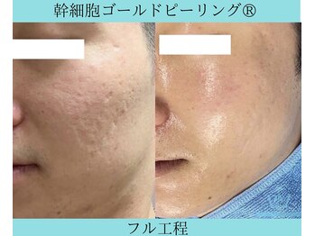 リメイククリニカルビューティー(Remake clinical beauty)/でこぼこを