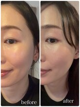 サロン シー(salon shhh...)/継続でトーンアップ