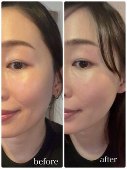 サロン シー(salon shhh...)/継続でトーンアップ