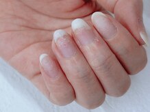 ビーエスネイル 金山店(bs-nail)/剥離した爪がキレイに見える