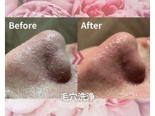 水素の力で奥の毛穴汚れもすっきりキレイに！