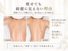 アネラ(Anela)