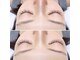 アイマジック バイ きれいデパート(eye magic)の写真/まつ毛もお肌もメンテナンス！ハリツヤ毛穴シミシワを整え美肌の改善を目指す☆