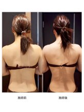 インディバ サロン フォーエバー(Forever)/背面 &nbsp;Before/After