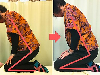 杉本接骨鍼灸院/階段を昇り降りするのが辛かった