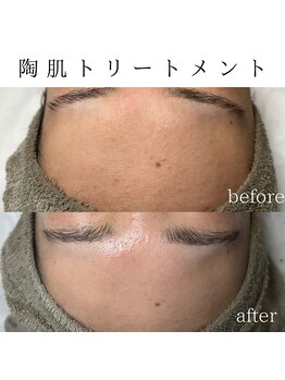 ビューティービューティー(BEAUTY BEAUTY)/