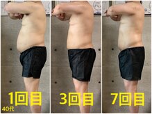 ペリー(PELLY)/男性40代　before after