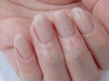 ビーエスネイル 金山店(bs-nail)/剥離した爪がキレイに見える