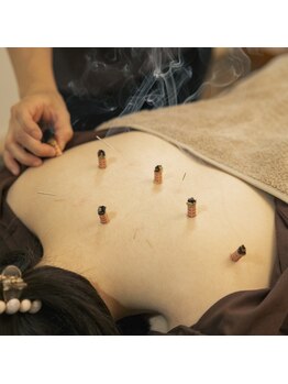 くろねこはりきゅう院/鍼灸施術は全身をケアします
