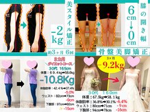 美骨矯正 ステキプロ(SUTEKI pro)の雰囲気（ダイエット・姿勢・根本疲労改善・ブライダルエステ(整体)に最適）