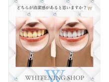 ホワイトニングショップ 本八幡店/ホワイトニング専門店 市川