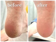 スナッピー ネイルズアンドブロウズ BLiX茅ヶ崎店(SNAPPY)