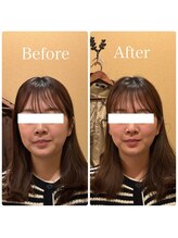 アキュレ(Acure)/