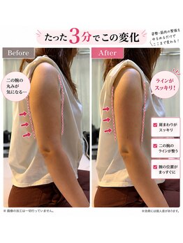 スリール(Sourire)の写真/【二の腕・ハミ肉を徹底ケア】巻き肩・猫背から整えて、華奢見えするスッキリ上半身へ♪