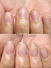 マリーロール 梅田店(Marie Laure)/自爪育成/深爪矯正/ネイルケア