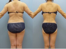 エピア 豊田店(Epia)/☆理想のボディーをゲット☆