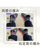 オアシス(oasis)/ビフォーアフター(１)