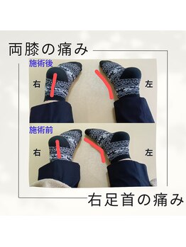 オアシス(oasis)/ビフォーアフター(１)