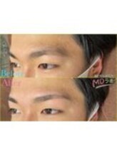 MDラボ 小松清六店/before after