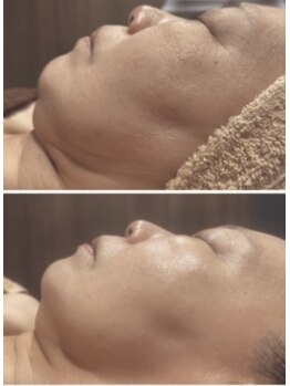 ペリドット(Peridot)/レモンボトル