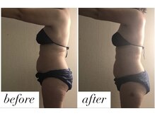 ベルシア(Bellucia)/