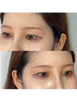 ドルフィン サロン(DOLPHIN salon)/平行アーチ　眉毛ワックス　