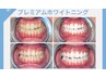 【2回目以降】白さキープ ホワイトニング★都度払いやお得なコースあり！