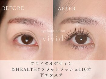 ビビッド(vivid)/パリエク進化版【&Healthy】