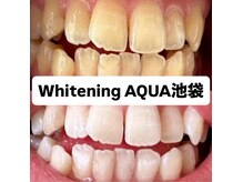 アクア 池袋店(AQUA)/ホワイトニング/池袋/東京/美白