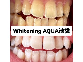 アクア 池袋店(AQUA)/ホワイトニング/池袋/東京/美白
