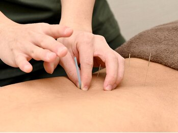 たくみ整骨院 綱島西口院/整体/鍼灸/美容鍼/マッサージ